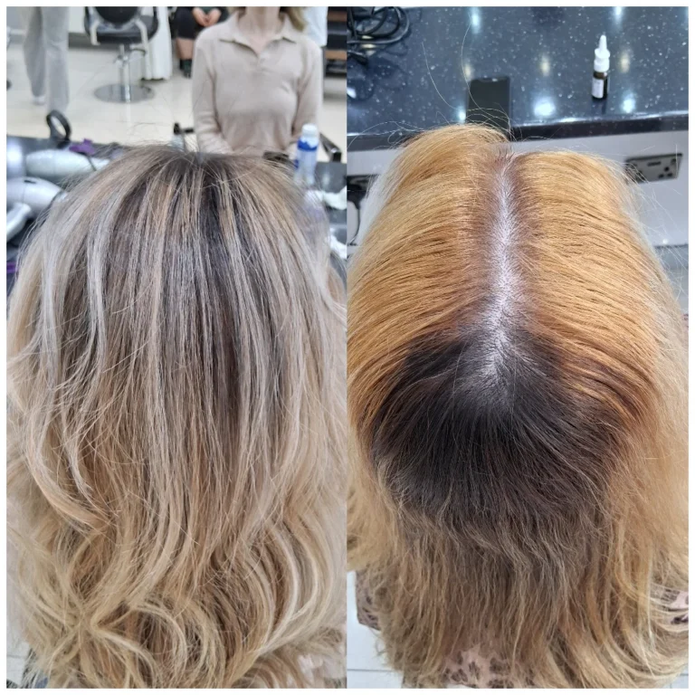 before_after (3)